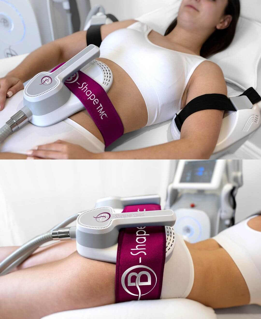 Traitement B-Shape chez Concept Beauté à Québec pour remodeler la silhouette, raffermir l’abdomen et cibler les graisses localisées.