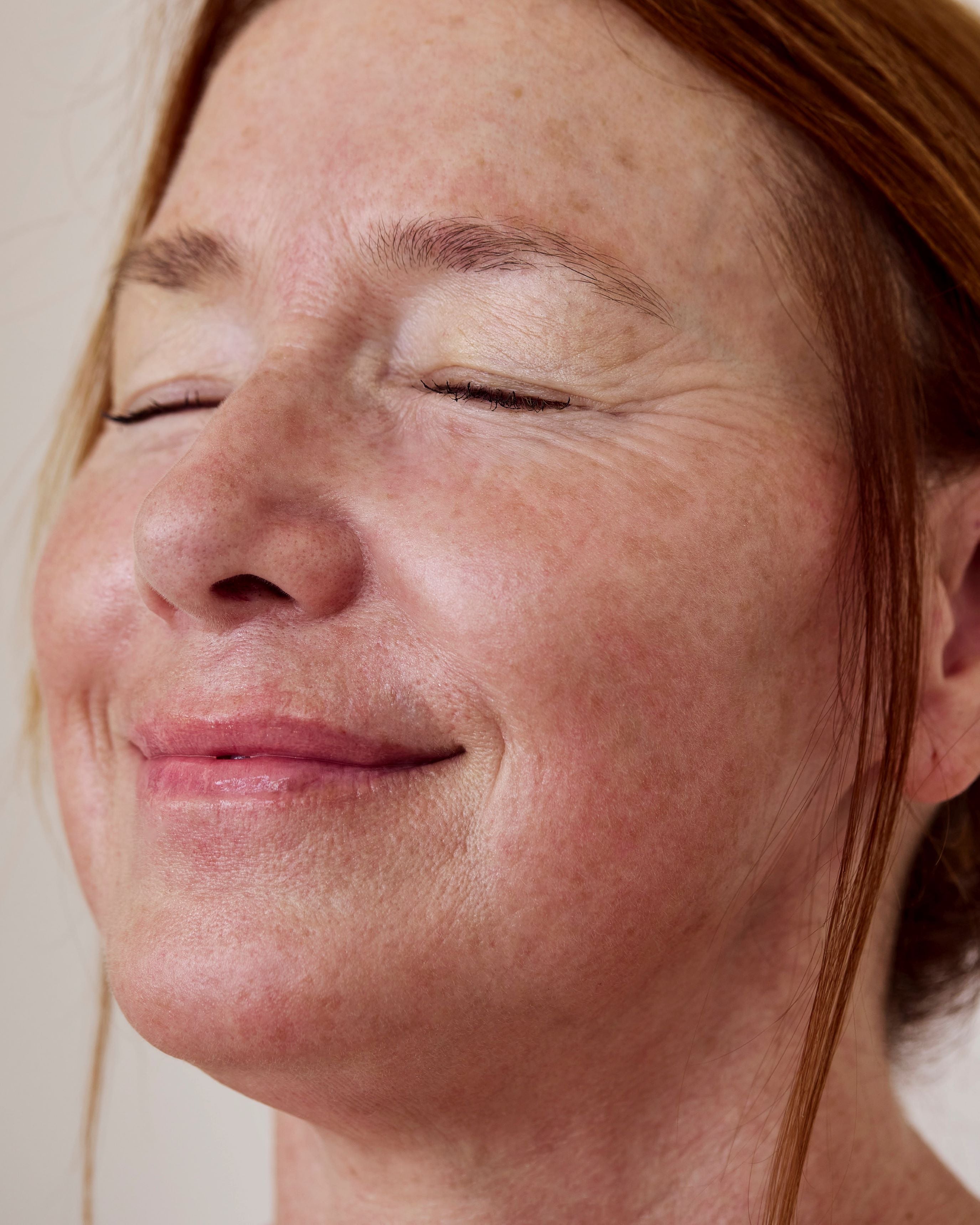 Photorajeunissement – soin médico-esthétique qui stimule le collagène et unifie le teint pour une peau éclatante.