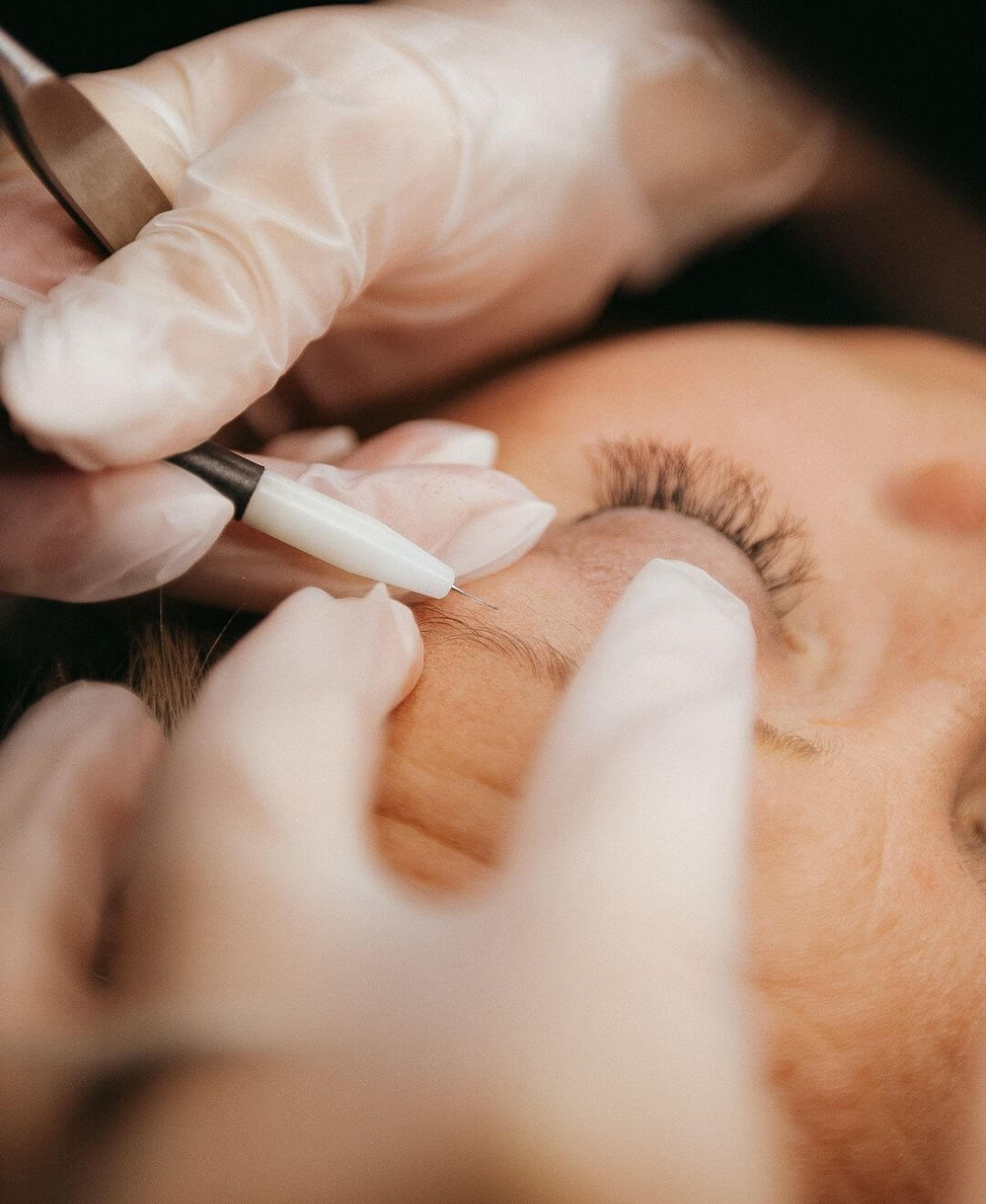 Électrolyse des sourcils pour élimination définitive des poils, Concept Beauté Cap-Rouge, Charlesbourg, Lac-Beauport