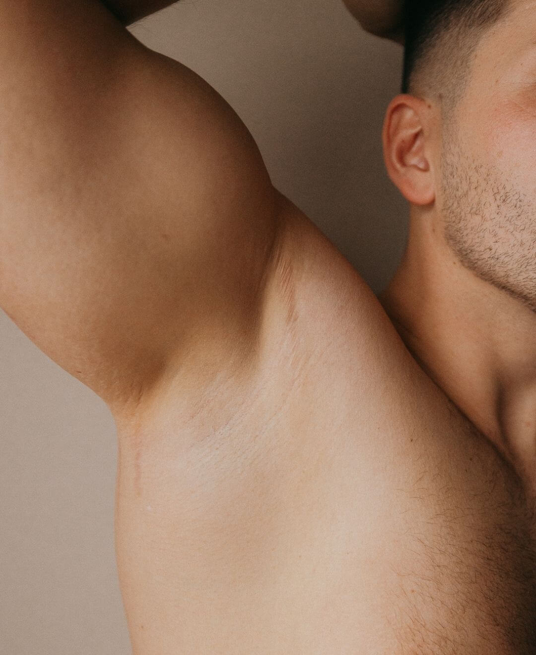 Épilation laser et lumière pulsée des aisselles pour homme, Concept Beauté Cap-Rouge, Charlesbourg, Lac-Beauport