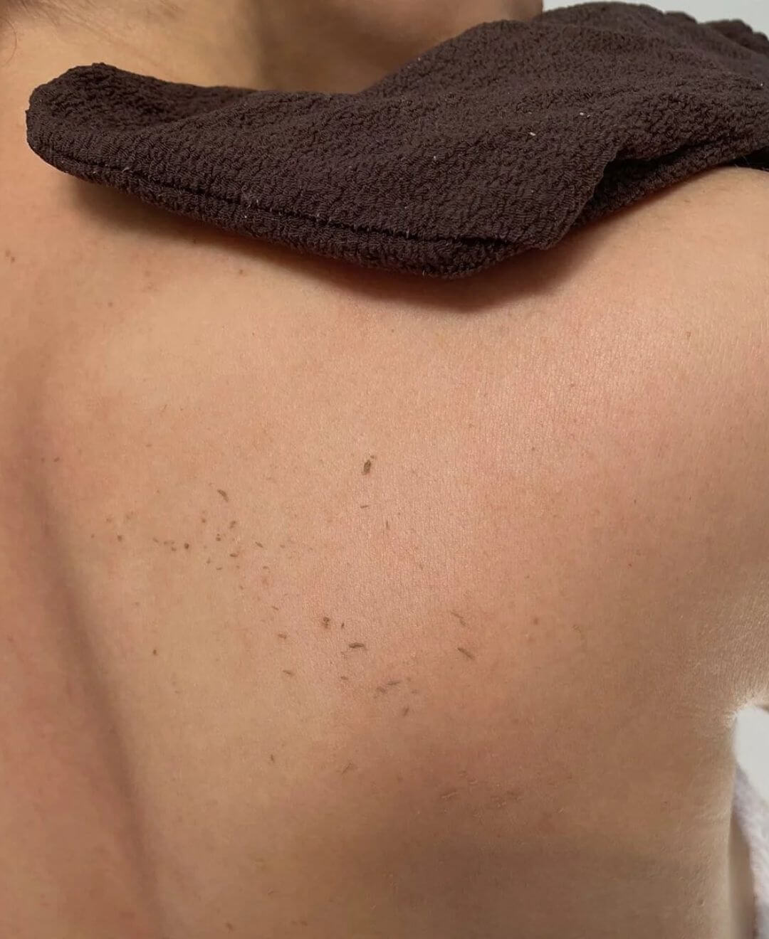 Gant exfoliant Renaissance qui élimine les cellules mortes du dos, affine la texture de la peau et révèle une peau plus lisse et uniforme.