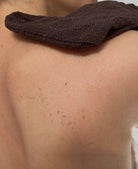 Gant exfoliant Renaissance qui élimine les cellules mortes du dos, affine la texture de la peau et révèle une peau plus lisse et uniforme.