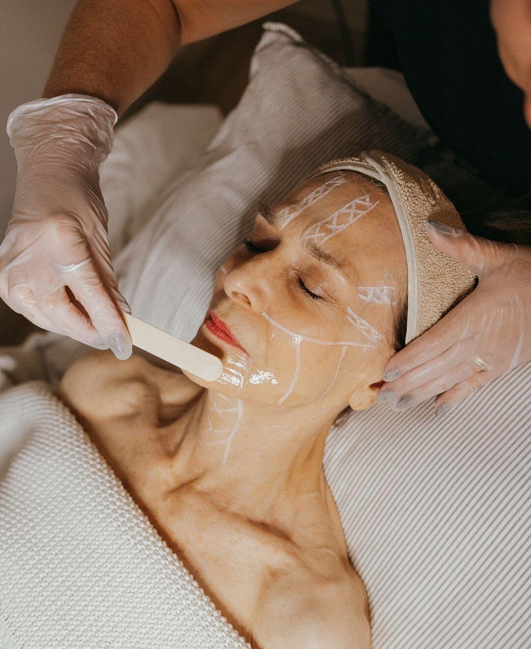 Traitement ProLift HIFU en cours chez Concept Beauté à Québec, soin raffermissant du visage et du cou sans chirurgie.
