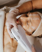 Soin ProLift HIFU du visage chez Concept Beauté à Québec, technologie raffermissante pour stimuler le collagène et lifter la peau.