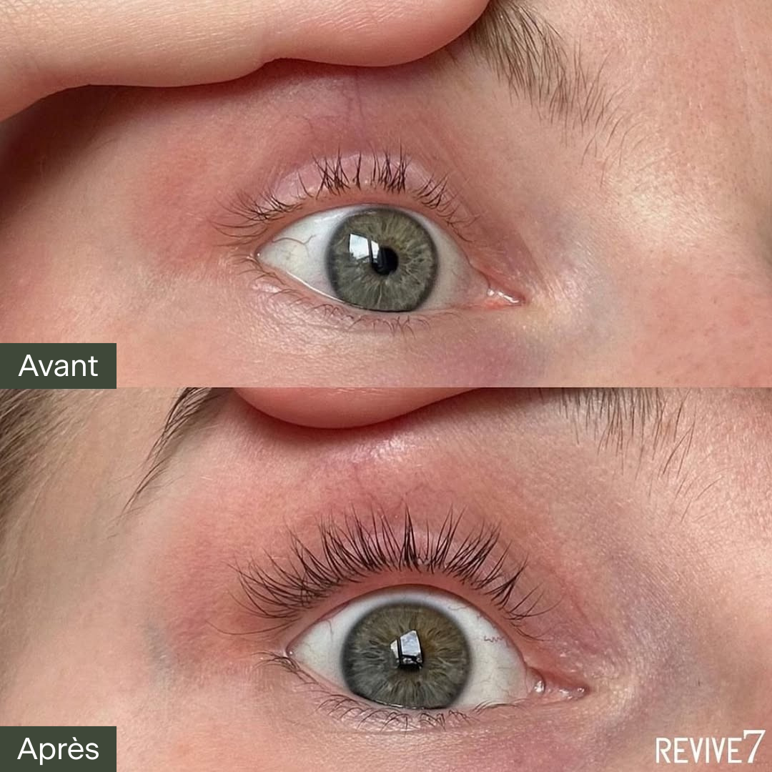 Image en deux parties montrant un œil vert en gros plan. En haut (Avant), les cils sont courts, clairsemés et peu recourbés. En bas (Après), les cils sont visiblement plus longs, denses, recourbés et en santé. Le changement est remarquable, illustrant les résultats possibles après l’utilisation du sérum pour cils Revive7. Ce produit favorise la croissance naturelle des cils en seulement quelques semaines, sans irritation, et est idéal pour obtenir un regard plus ouvert sans maquillage ni extensions.