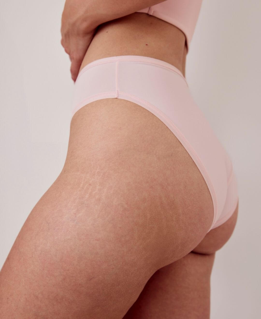 Traitement B-Shape chez Concept Beauté à Québec pour raffermir les fesses et atténuer l’apparence de la cellulite.