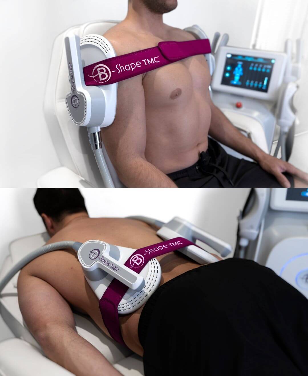 ALT – Image :
Traitement B-Shape pour homme chez Concept Beauté à Québec, ciblant les muscles pectoraux et le dos pour tonifier et raffermir.